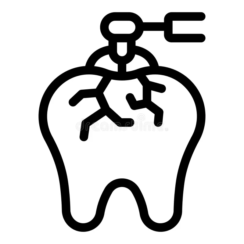 Impacted Canine Treatment Impacted Canine Treatment